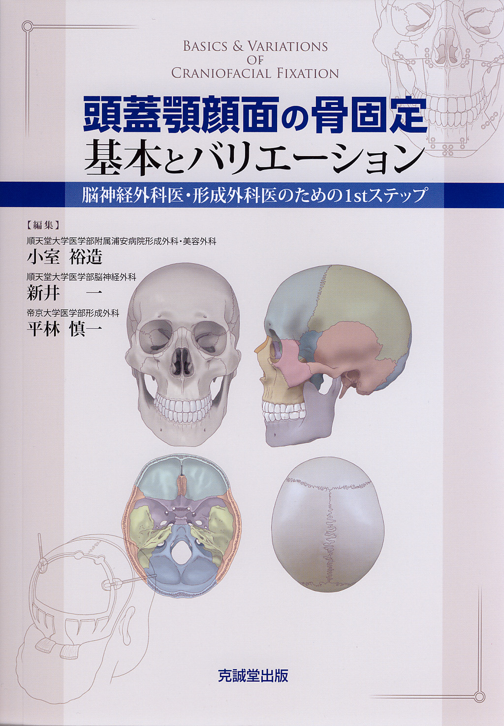頭蓋顎顔面の骨固定　基本とバリエーション　