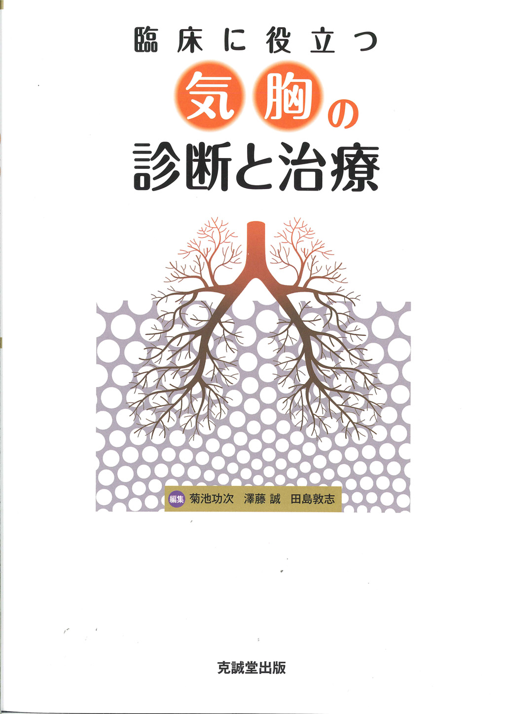 気胸の診断と治療