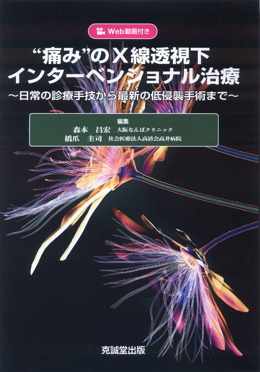 「痛み」のX線透視化インターベンショナル治療