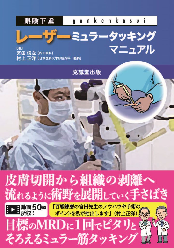 眼科 | 克誠堂出版 眼瞼下垂レーザーミュラータッキング